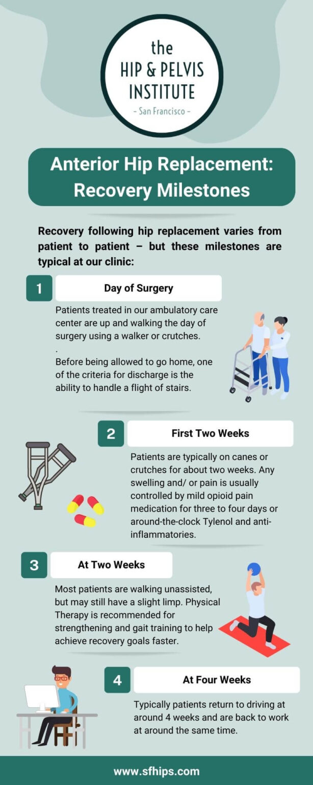 Anterior Hip Replacement Recovery Milestones - SF Hips